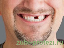 показания  к протезированию зубов